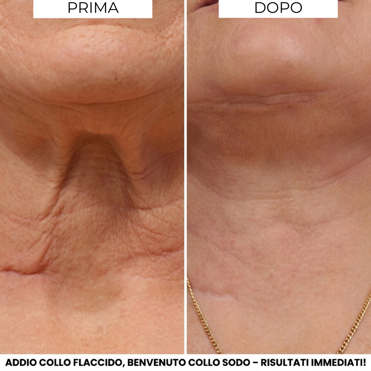 Crema Evonex® LiftingCollo™