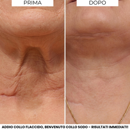 Crema Evonex® LiftingCollo™