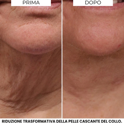Crema Evonex® LiftingCollo™